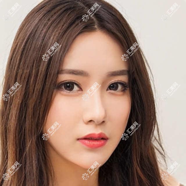 南充眼科及整形医生推荐:谭青青、杨彩霞、苟磊,近视手术与眼部美容优选!
