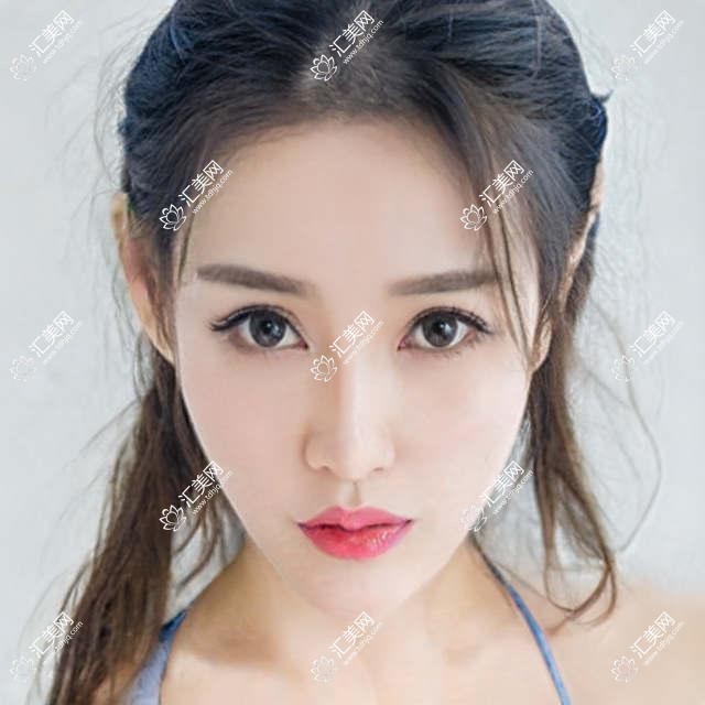 深圳光爱眼科诊所眼科项目价格揭秘：近视激光&白内障手术等全面解析