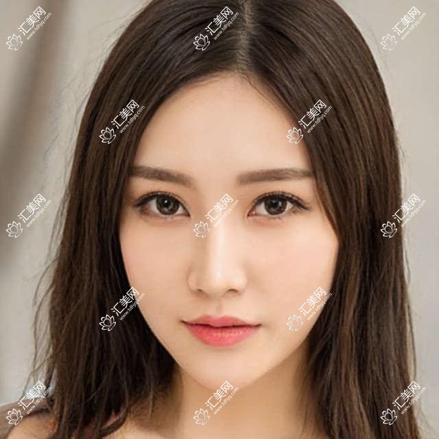 潍坊近视手术医生杨明张浩润如何?ICL晶体植入手术备受推崇!