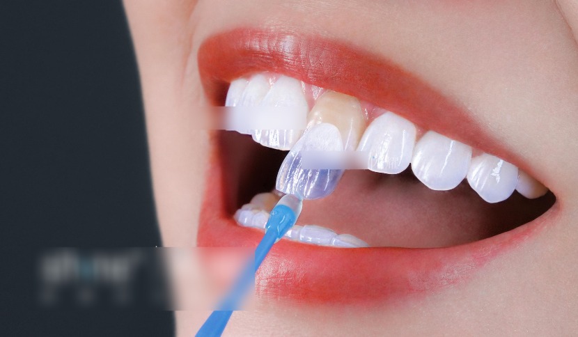 一、城步凯瑞口腔