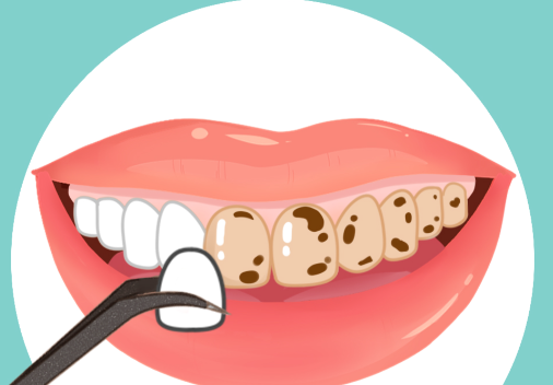 二、城步牙科私人医院