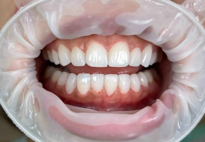 五、就诊攻略与建议