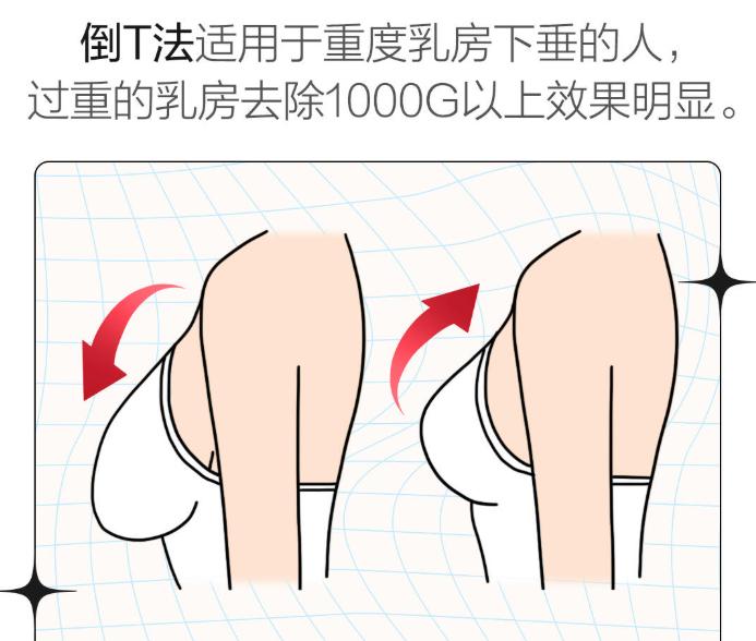 珠海哪家医院可以做缩胸手术？九龙整形、韩妃医美、新颜医美更受关注