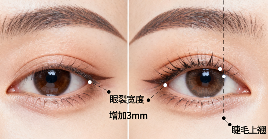 温州正规双眼皮哪里好？雅美姬、和平、芘丽芙三家更受求美者关注