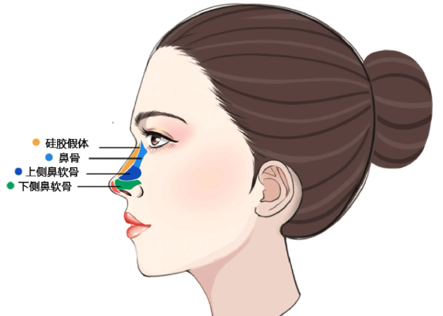 段焘做男士鼻子用仿生骨雕技术，自然到素颜敢出门