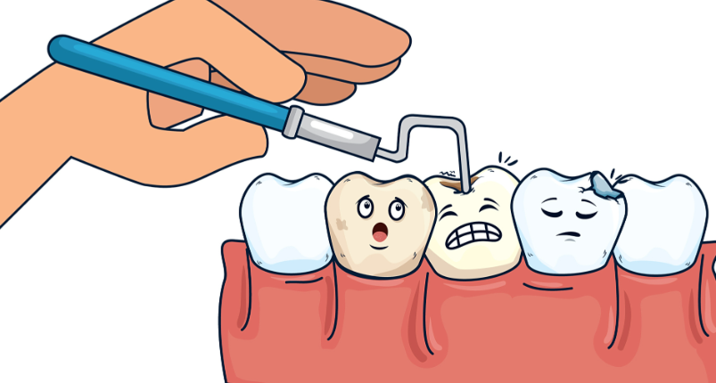 玻璃离子和树脂补牙的区别在哪？2026年寿命价格适用场景全解析来了！