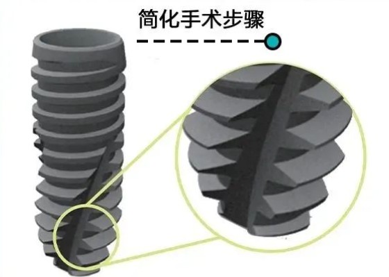 二、官方质保条款解析:终身确保背后的技术要求